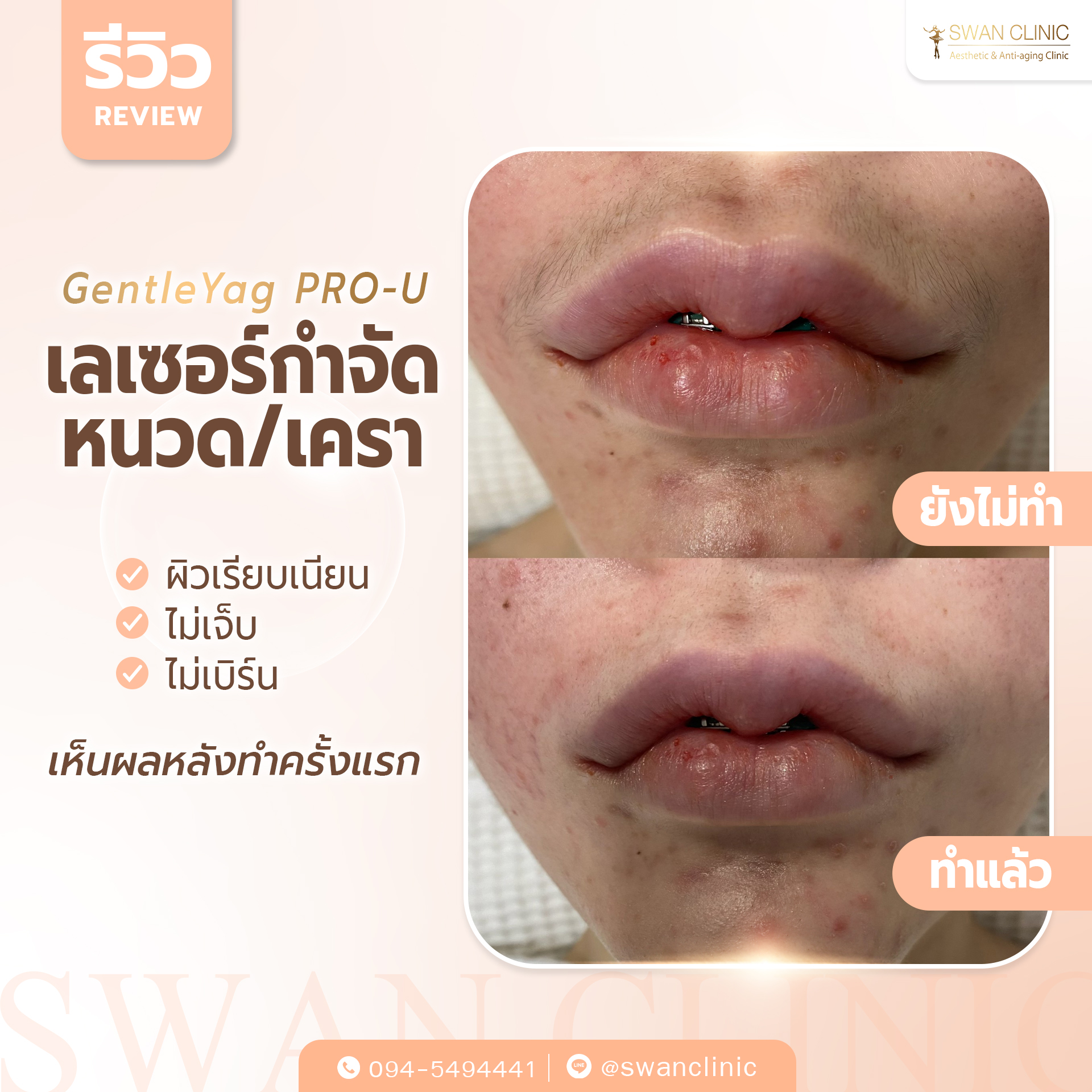 Swan Clinic review 2