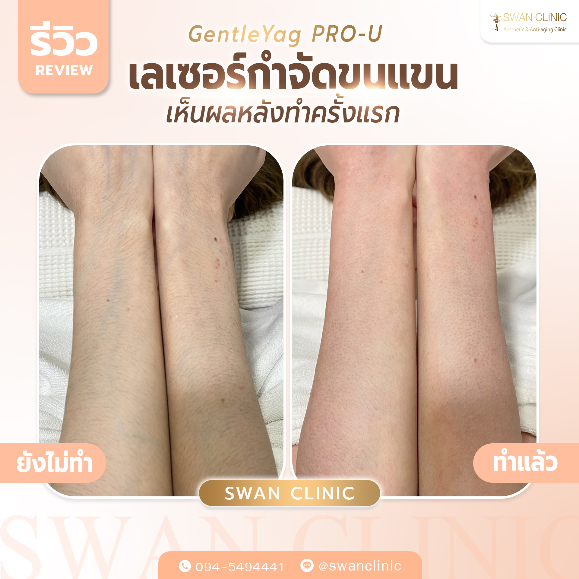 Swan Clinic review 4