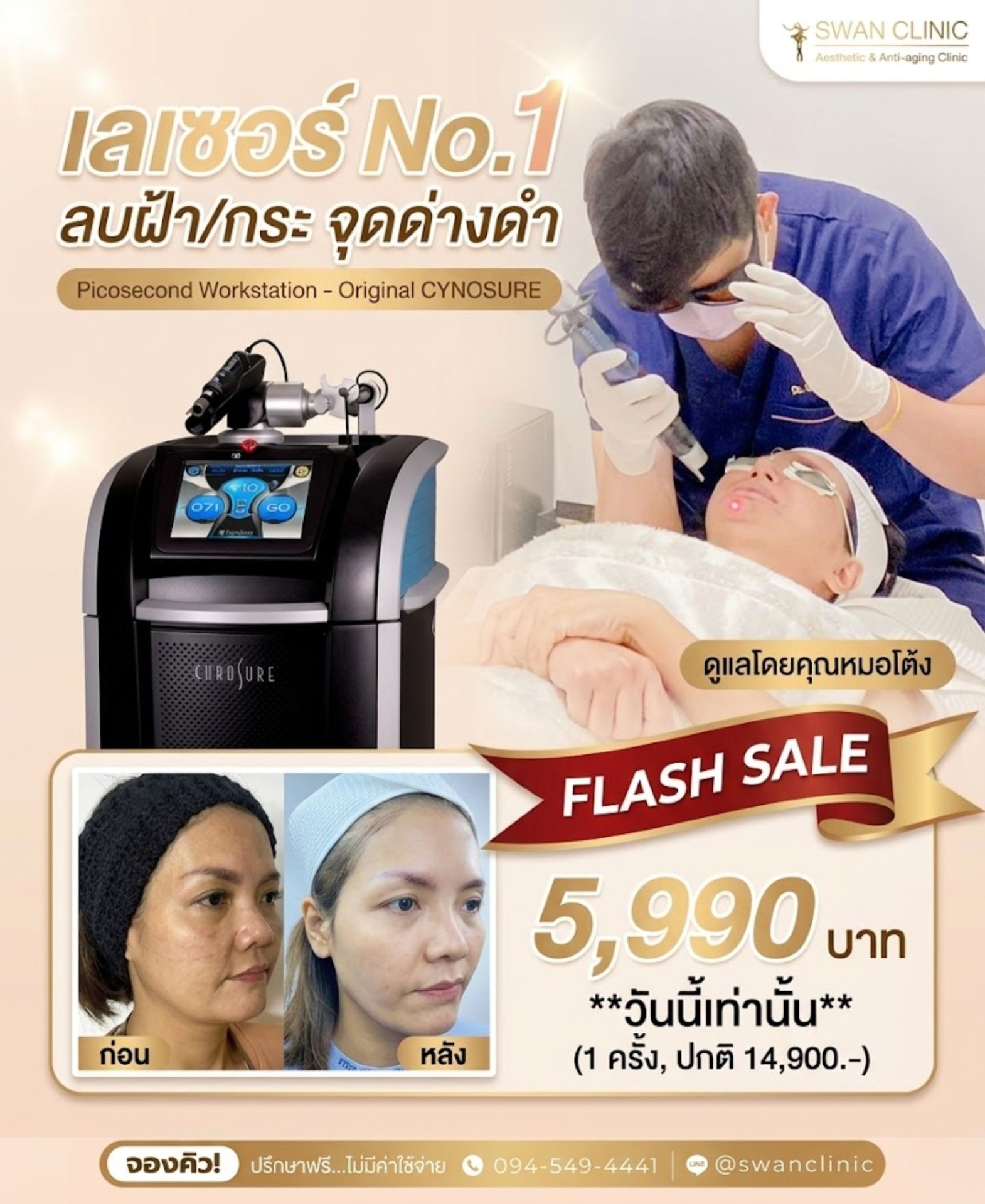 เลเซอร์ No.1 ลบฝ้า/กระ จุดด่างดำ